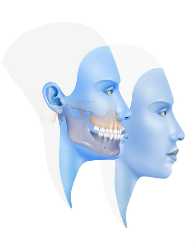 Cirugía oral y maxilofacial